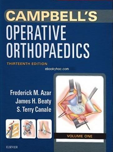 Campbell's Operative Orthopaedics, 4-Volume Set, 13e PDF free